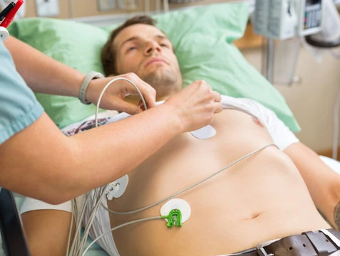 Imagem ilustrativa de Eletrocardiograma