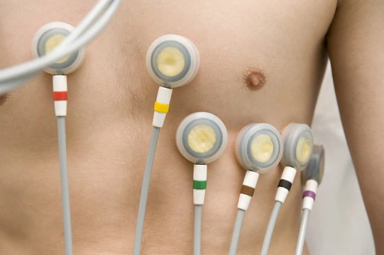 Exame ecg