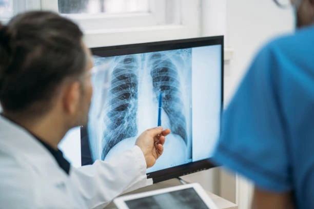 Pneumologista para asma